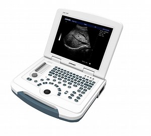 [Hot Item] Efficient Ultrasound Scan Machine High Resolution