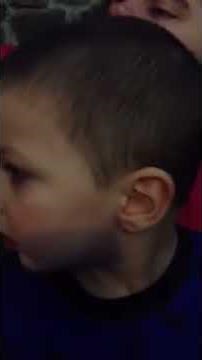 Aberrant Gaze Saccades or Intermittent Involuntary Gaze (IIG) 4
