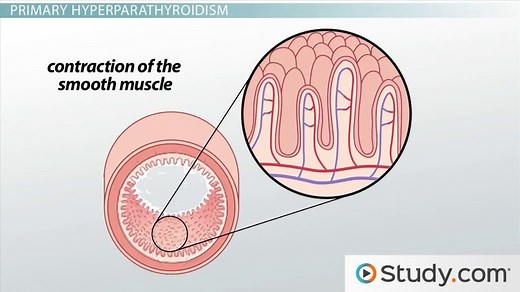 Primary vs. Secondary Hyperparathyroidism | Causes & Symptoms