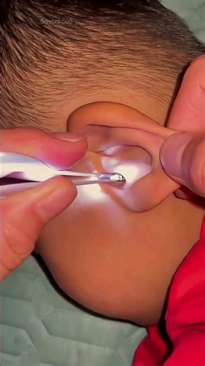 🌟Smart Ear Wax Remover with LED Light | Safe & Gentle Ear Cleaning Tool #3392 ‪@sovorsgadget‬