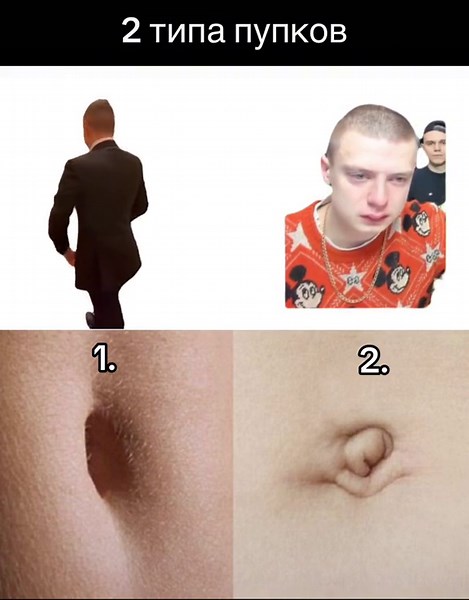 Какой тип пупка у тебя? #bodytype#пупок#тело#мем