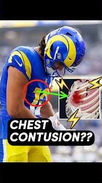 Doctor explains Puka Nacua chest wall injury #Rams #Puka #FantasyFootball #injury #education
