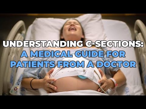 Everything You Need to Know About C-Sections: A Doctor's Guide for Expecting Parents