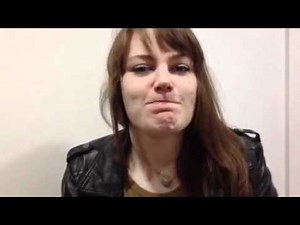 Gluing my lips together