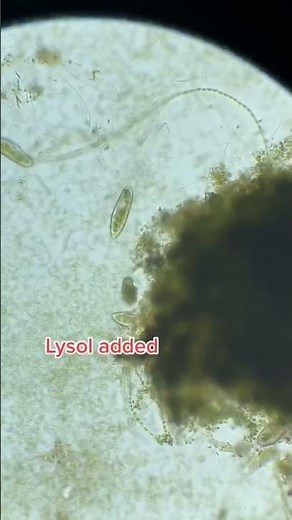 Cell Explodes Under Microscope (Lysol Added) #microscope #science #microscopy