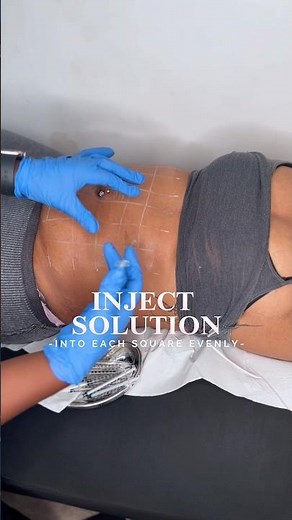 How To Do Fat Dissolving Injections | Reduce Stubborn Fat | Fat Melting Injections