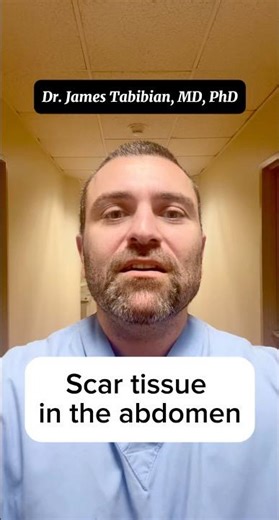 Scar tissue in the abdomen ⚠️