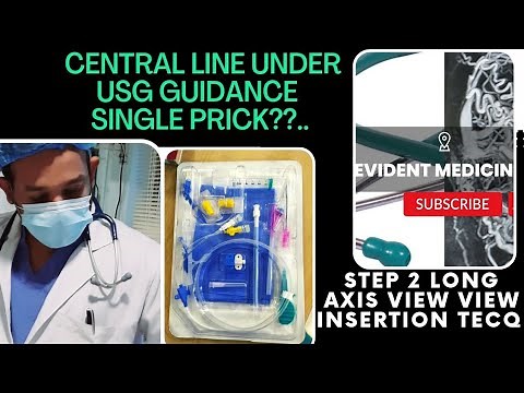 USG GUIDED CENTRAL LINE INSERTION(IJV route) #centralline#procedure