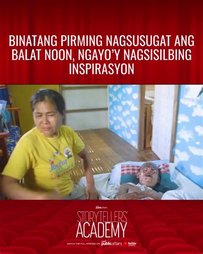 BINATANG PIRMING NAGSUSUGAT ANG BALAT NOON, NGAYO’Y NAGSISILBING INSPIRASYON Ang mga kuwento, makapangyarihan at kayang makapagpabago ng buhay. At ang nagsisilbing patunay riyan… si Daxen. Siya ang binata mula Antique na dating pirming nagsusugat ang balat. Sa tulong ng mga manonood ng #KMJS, ang kanyang buhay… tuluyan nang nagbago. Si Daxen, mula Antique, lumipad para dumalo sa kauna-unahang Storytellers’ Academy ng GMA Public Affairs at magsilbing inspirasyon sa bagong henerasyon ng mamamahaya