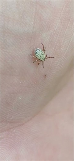 Wood tick (American dog tick) is parasite of humans & dogs#arachnid #parasite #wildlife #dog #zoo