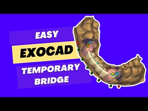 Easy Design a 3D printed Temporary Dental Bridge (Exocad Tutorial)
