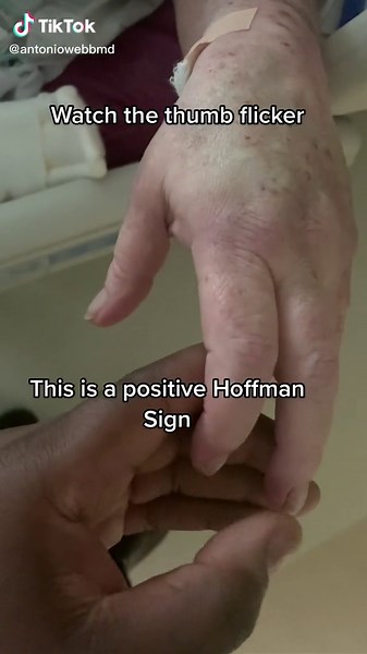 antoniowebbmd on TikTok