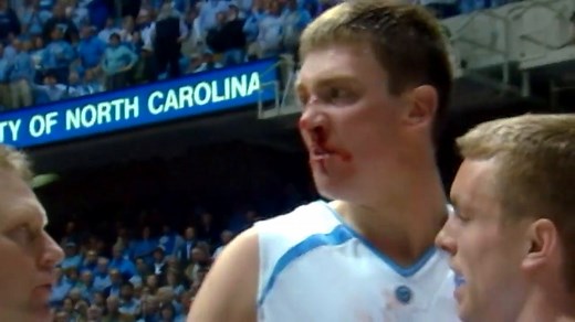 That time UNC Basketball's Tyler Hansbrough got his nose broken 😳 "They were probably tired of him kicking their ass" — Danny Green | ACC Network