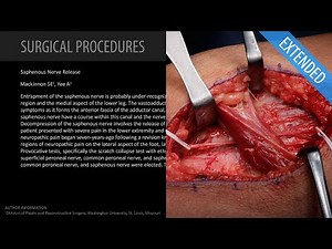 Saphenous Nerve Release - Extended (Feat. Dr. Mackinnon) • Video • MEDtube.net