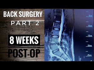 Back Surgery |L4-L5 Laminectomy| Recovery part 2