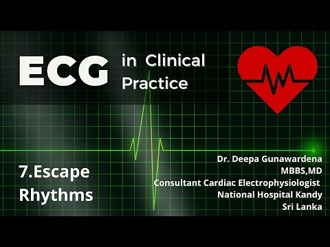 Escape Rhythms | Lesson 9