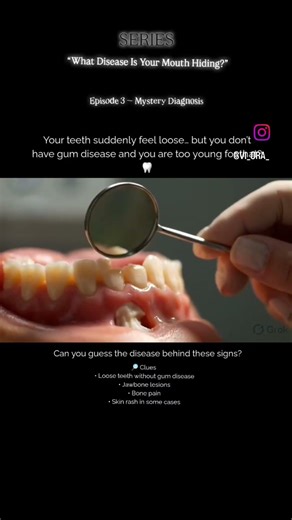 Your teeth suddenly feel loose… but you don’t have gum disease.