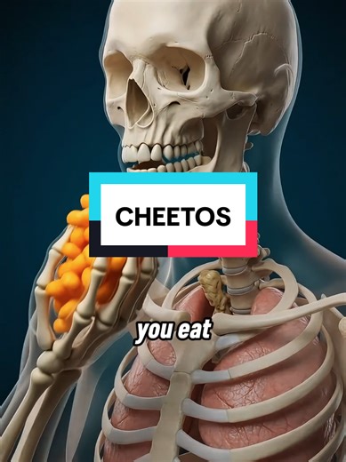 when you eat Cheetos daily this is what happens inside your body #health #learnontiktok #cheetos #medicaltiktok