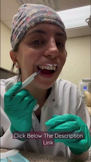 Let's Make Vampire Fangs! #permanentfangs #fangs #permanentfangs #permanentvampirefangs #vampire