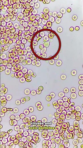 White blood cells fight infection under the microscope! RARE FOOTAGE!