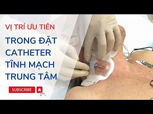 Vị trí nào được ưu tiên trong đặt catheter tĩnh mạch trung tâm? - Giai thích chi tiết