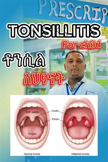 መድሀኒት እና መድኃኒት ለቶንሲል በኢትዮጵያ