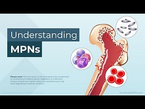 Understanding MPNs