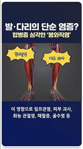 발‧다리의 단순 염증? 합병증 심각한 ‘봉와직염’