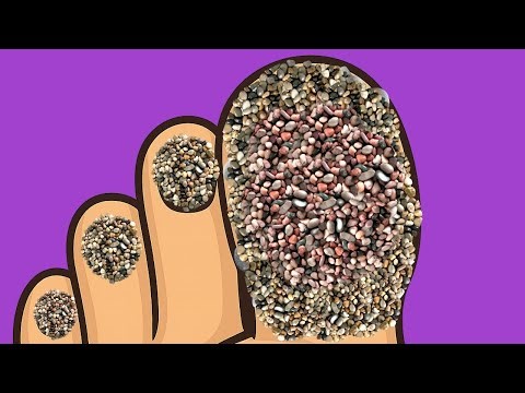 Asmr / Watch Toe care it will gives you relaxation and deep sleep❣️