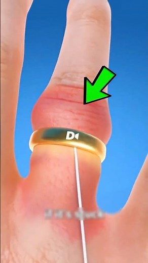 Ring stuck on your finger? Don’t panic—here’s what to do!? 😁