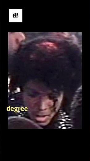 🔥 The Day Michael Jackson Caught Fire – The Truth Behind the Incident #tragedy #michaeljackson