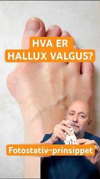 Derfor blir stortåen skjev! Fotkirurgen forklarer Hallux Valgus | Dette skjer med foten din