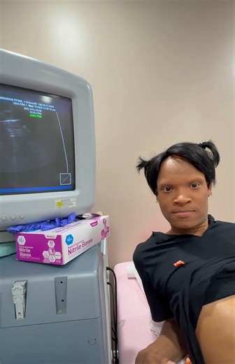 3.1M views · 98K reactions | I’m PREGNANT and this ultrasound technician keeps PLAYING in my face!!  - Click the link in my bio to watch the FULL video on YouTube‼️ | Norman Freeman | Facebook