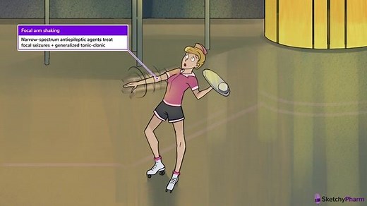 Carbamazepine, oxcarbazepine, phenytoin, tiagabine, vigabatrin - Free Sketchy Medical Lesson