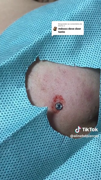 O Maravilhoso Mundo do Microdermal: Aplicação e Cuidados