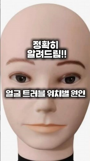 Causes of facial blemishes by location