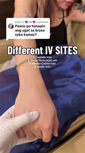 Different IV Sites: Cephalic, Dorsal Metacarpal, Median Cubital, Basilic
