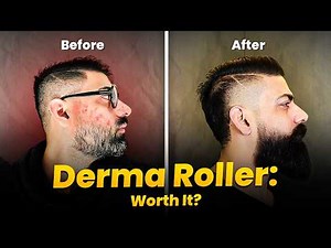 Derma Roller for Men: BENEFITS and RISKS You Need to Know