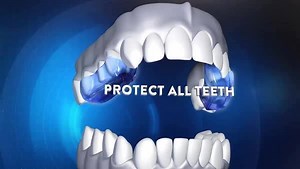 3 comments | Introducing NEW DenTek® Ultimate Dental Guard! The ultimate in comfort and protection. | DenTek Oral Care | Facebook