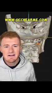 Are you dealing with #vertigo or #dizziness that you just can’t seem to get to the bottom of? There’s a good chance that it may be coming from this region right here. Misalignment in the upper neck can cause #vestibulardysfunction and all the symptoms you may be experiencing Correcting the upper neck can lead to resolution of these issues | Upper Cervical Chiropractor Near Me