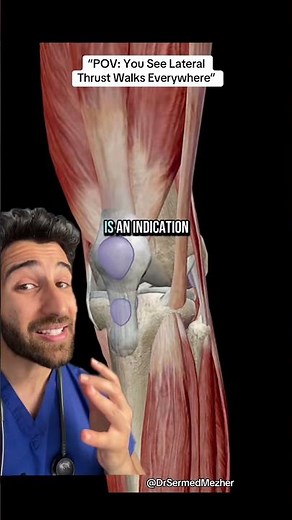 “POV: You See Lateral Thrust Walks Everywhere” #explain