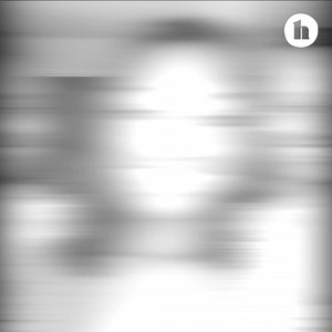 110 reactions · 19 shares | Watch Randi's rheumatoid arthritis journey from symptoms to diagnosis to advocacy. | Healthline | Facebook