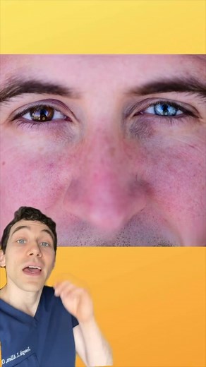 Learn about what it means to have 2 different eye colors and the beauty of heterochromia! 👁️✨ Heterochromia is a fascinating condition characterized by a difference in coloration of the iris, the colored part of the eye. This variance results in one eye having a distinct hue from the other or even within the same eye, where sections of different colors are present. Heterochromia can manifest in various forms, such as complete heterochromia, where each eye has a completely different color, or se