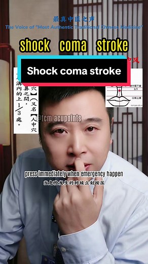Magic acupoint of your body , good for your shock comma and stroke#shock #coma #stroke #shocking #shocked #shockbreaker #strokeawareness #firstaid #aid #emergency #emergencymedicine #emergencyservices #healthy #chinesemedicine #tcm #foryou #acupuncture #