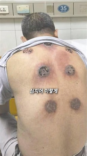 The #1 medical scam that has the whole country fooled..