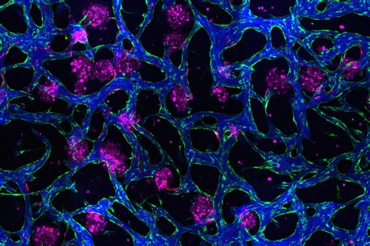 New tissue models could help researchers develop drugs for liver disease