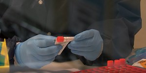 DHEC addresses data processing issue, says testing delays caused by private lab are resolved