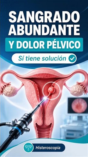 Heavy bleeding and pelvic pain: Hysteroscopy as a solution #Hysteroscopy #Gynecology