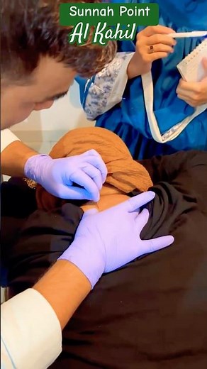 🔥💉 The Most Powerful Hijama Point – Al-Kahil (Sunnah) | 🕌 Sunnah Cupping Procedure
