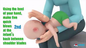 84K views · 227 reactions | How to help a choking child or infant? Learn First Aid skill and keep your family safe. | First Aid | Facebook
